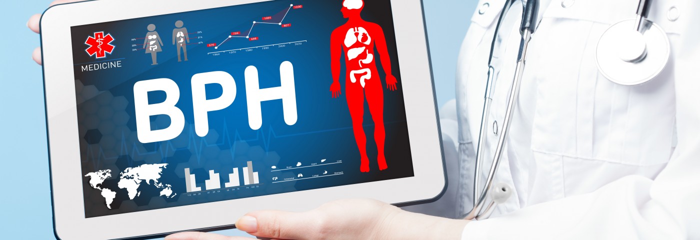 Updated Guidelines Published for BPH Treatment and Symptom Management