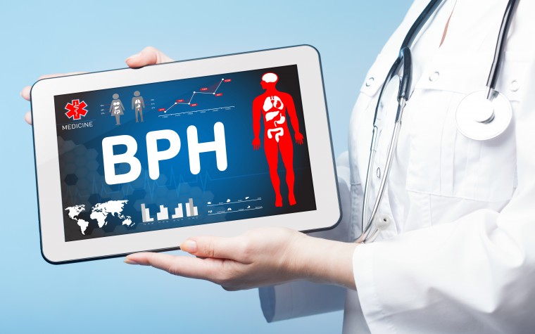 Updated guidelines for BPH treatment